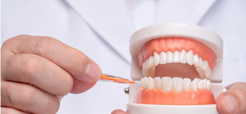 Tratamiento y limpieza de encías Santa Rita Dental